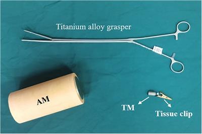 Clinical application of magnetic anchor technique in laparoscopic cholecystectomy: the first retrospective study in China